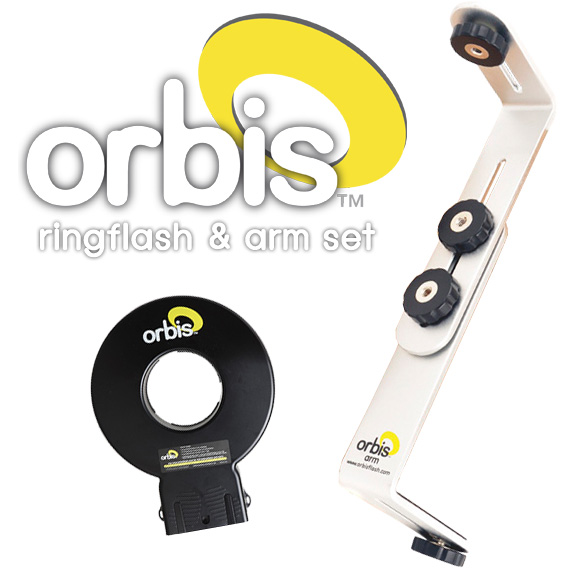 Orbis ������ ���÷��þ�� + �� ��Ʈ